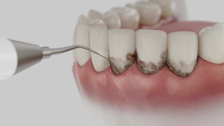 Reliable Emergency Dentist contractor in Fulton, MD by Smile Center Dentistry